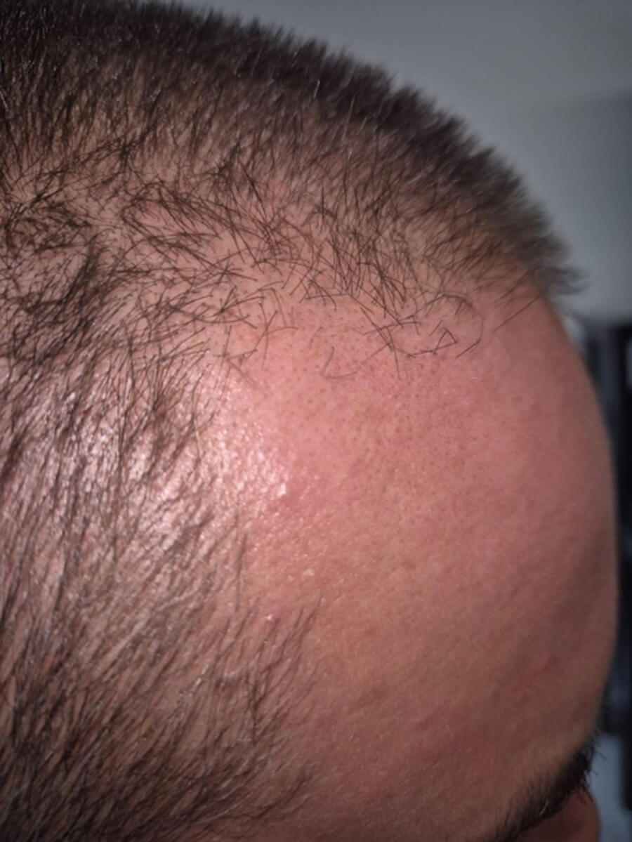 Photo showing patient after 4 weeks.