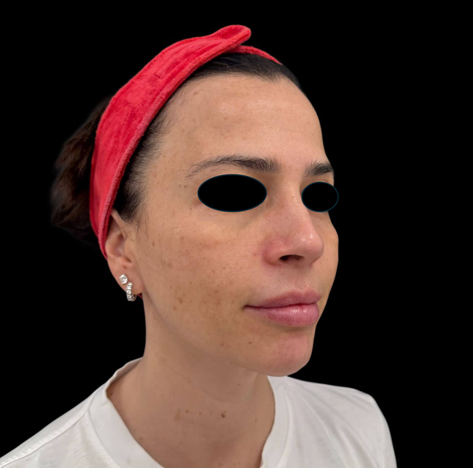 Photo showing patient before treatment.