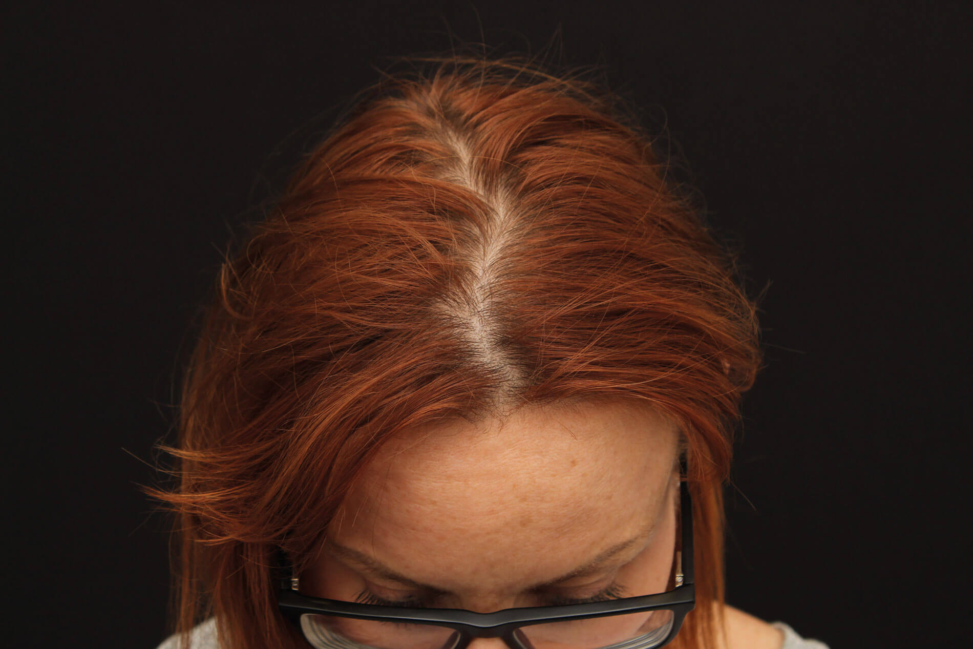 Photo showing patient before treatment.