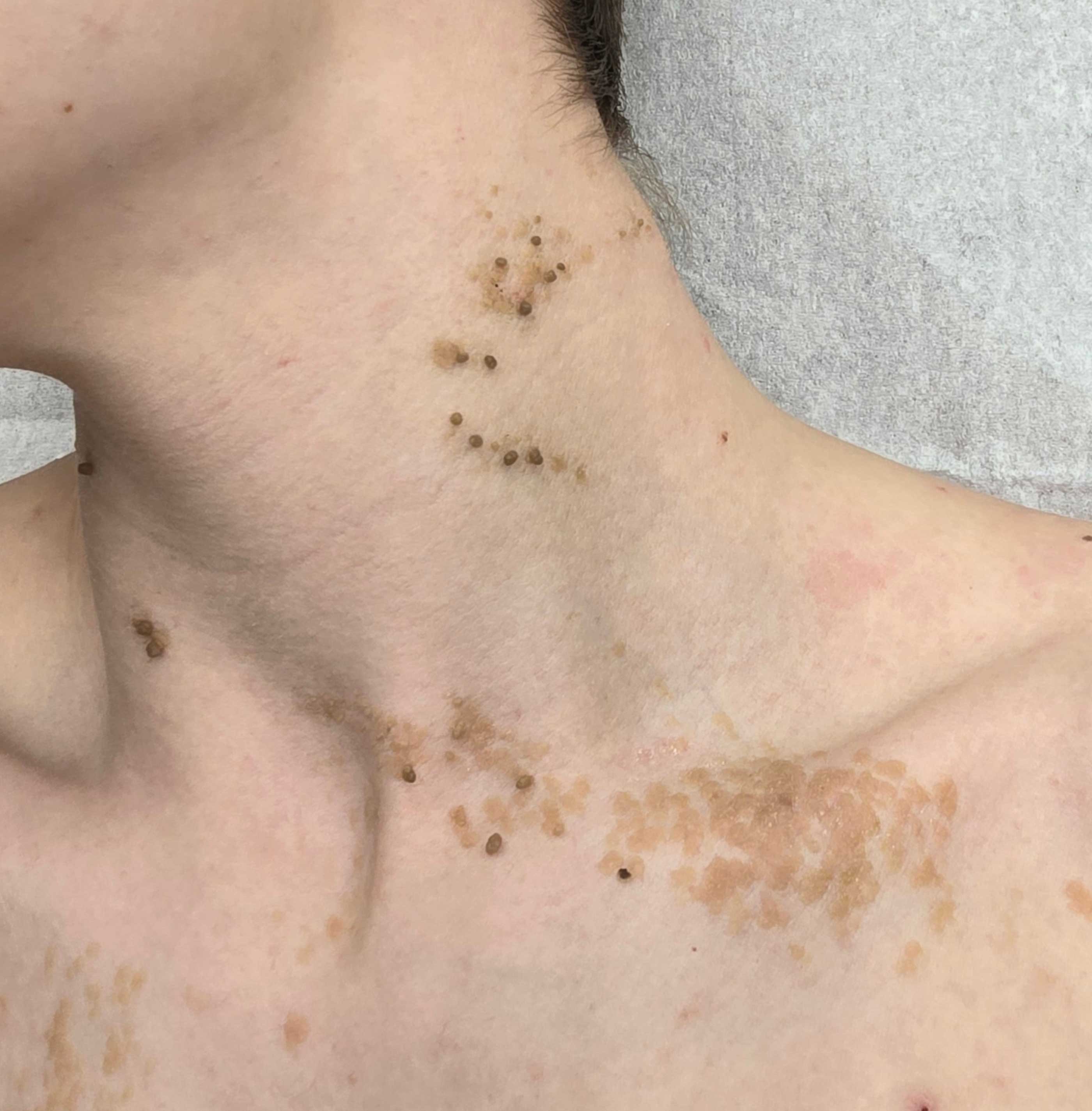 Image showing before treatment.