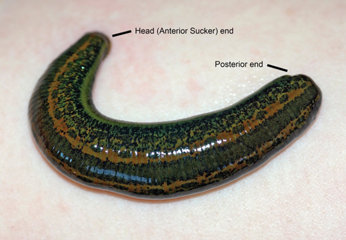 medicinal leech therapy in